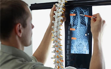 Scoliosis Fusion Surgery