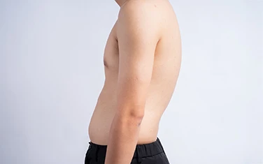 Post-Traumatic Kyphosis